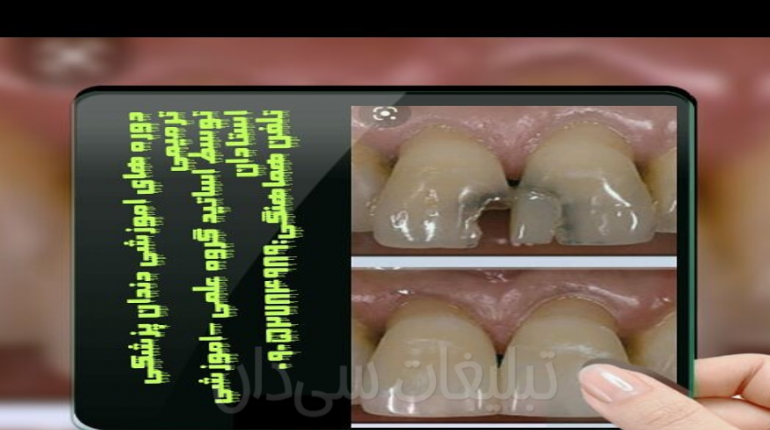 آموزش بهدار دندان و دندان ساز تجربی