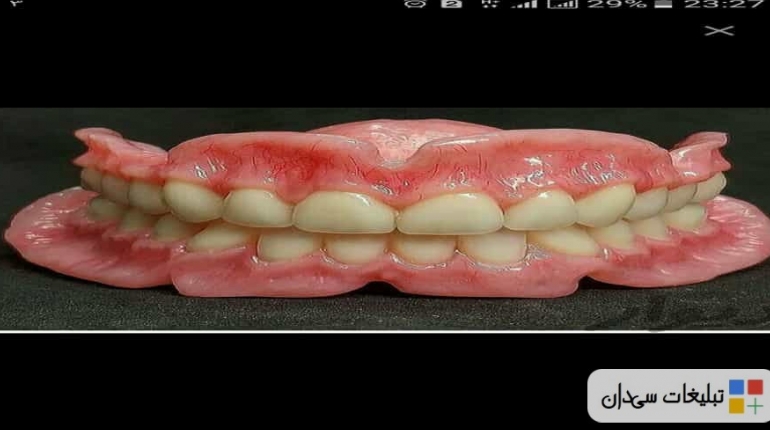لابراتوار دندانسازی ساخت دندان مصنوعی ژله ای ضمانت