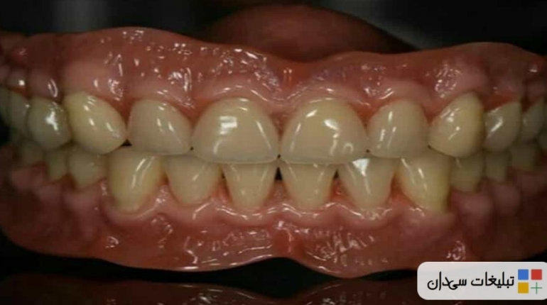 لابراتوار دندانسازی اقساطی