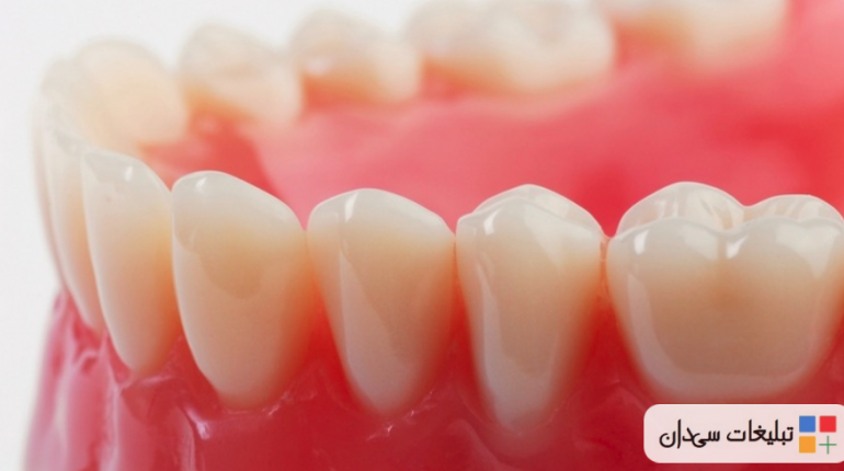دندانسازی تجربی نابس دنت