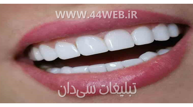 دندان پزشکی و زیبایی