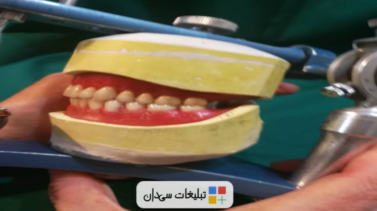 ساخت دست دندان مصنوعی